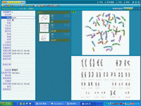 染色体分析系统
