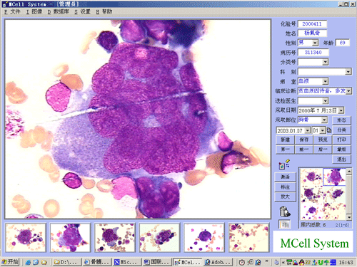 骨髓细胞形态学软件