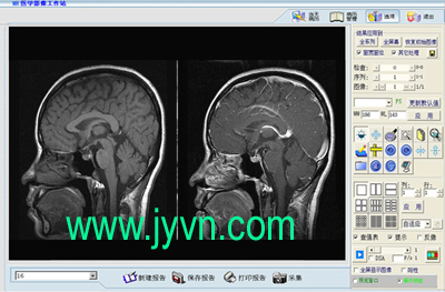 磁共振工作站软件|数字工作站软件|MRI工作站|放射工作站|工作站软件