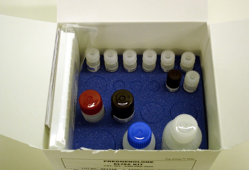 抗甲状腺过氧化物酶自身抗体（Anti-TPO）检测试剂盒（血清）