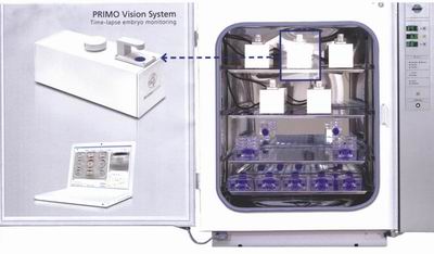 胚胎观测仪