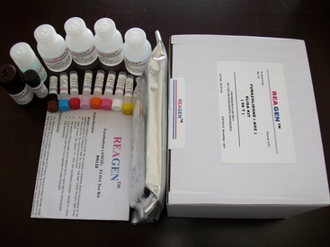 美国reagen大肠杆菌o157检测试剂盒