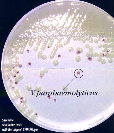 法国科玛嘉弧菌显色培养基
