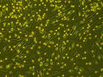 PriCells-小鼠II型肺泡上皮细胞