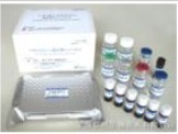 人免疫球蛋白M(IgM)ELISA Kit
