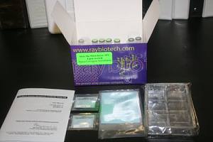 脂联素ELISA试剂盒