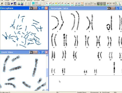 ASI染色体光谱分析系统