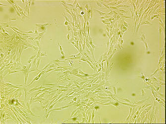 原代血管平滑肌细胞 (SA-VSMC-001)