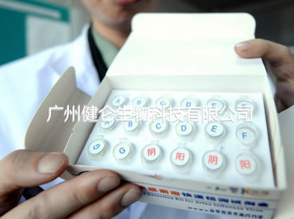甲型H1N1流感病毒RNA检测试剂盒(荧光PCR法)