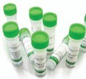 肝素诱导性血小板减少症试剂盒