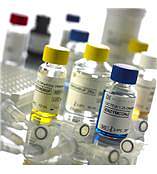 lymphoprep分离液,1.077密度分离液,淋巴细胞分离液