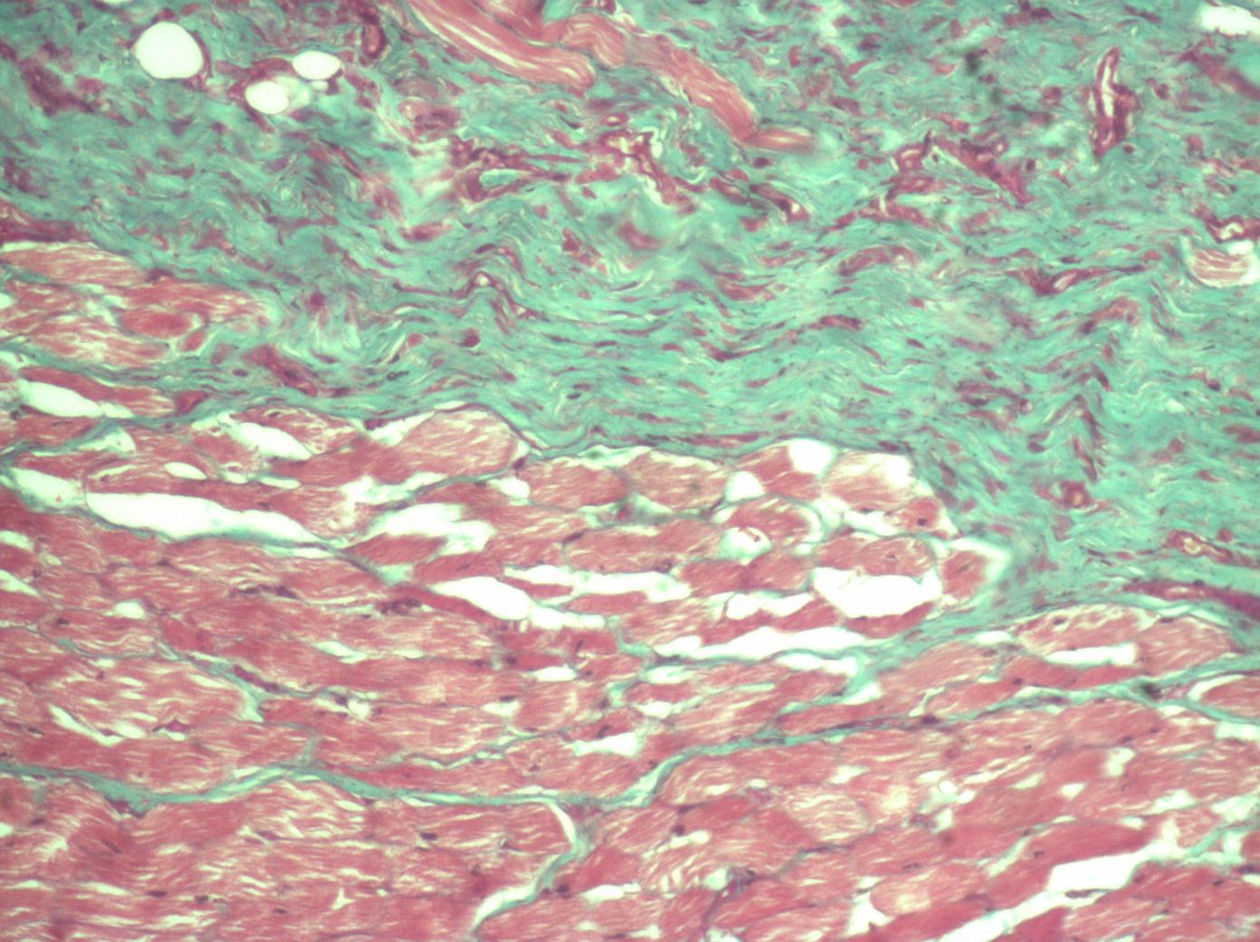 masson三色染色及显微拍照