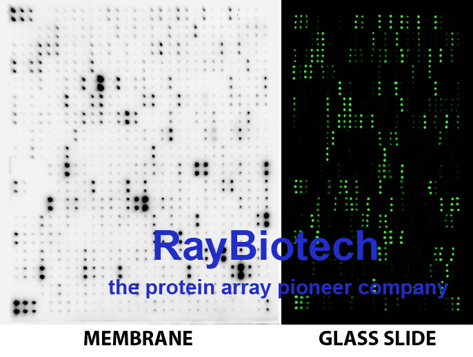 RayBiotech趋化因子检测抗体芯片