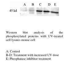 Phospho-Serine Antibody
