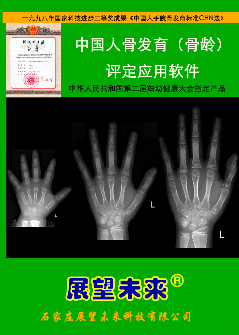 中国人骨发育（骨龄）评定应用软件（骨龄软件）——临床专家版