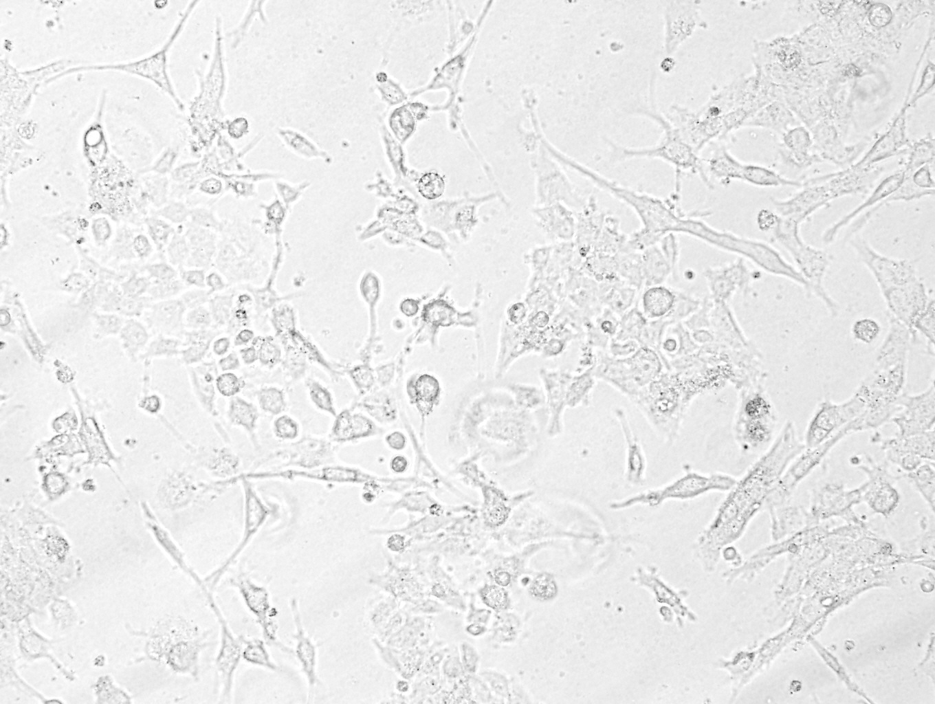 Hepa 1-6细胞小鼠肝癌细胞