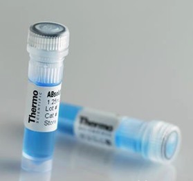 HRP标记山羊抗人二抗IgG
