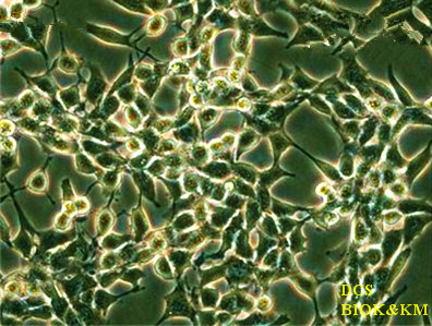 小鼠树突状细胞肉瘤细胞，DCS