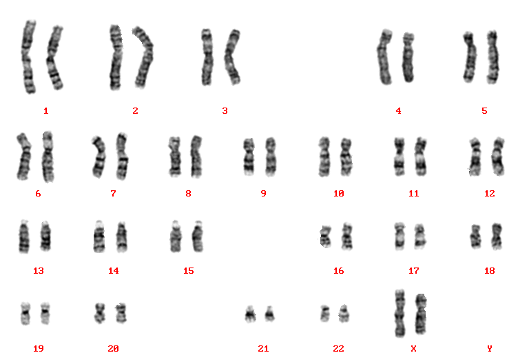 G显带 染色体