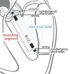 心室压力导管、压力容积导管、PV导管