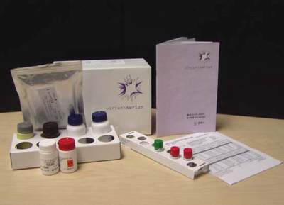 腮腺炎病毒IgM试剂盒