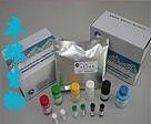 沙门氏/志贺氏菌双重双色核酸检测试剂盒（PCR-荧光探针法）