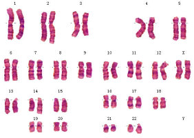 染色体核型分析