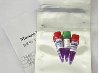 小鼠白介素2可溶性受体β链(IL-2sRβ)ELISA试剂盒