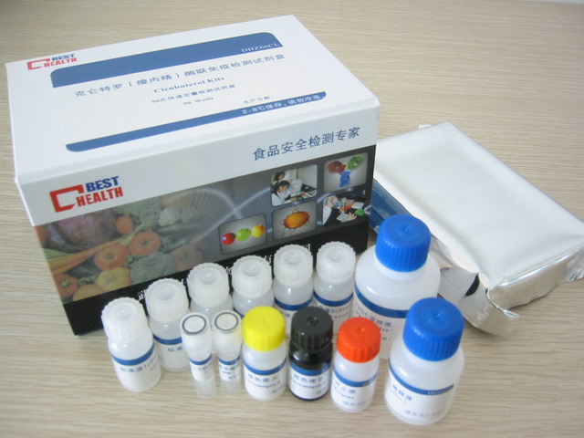 人心型脂肪酸结合蛋白(h-FABP)ELISA试剂盒