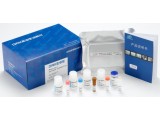 人脱氧尿三磷酸(DUTP)ELISA试剂盒