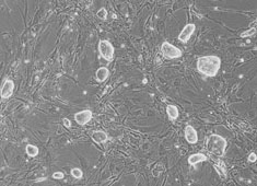 非雄激素依赖型前列腺癌,Tsu-Prl细胞