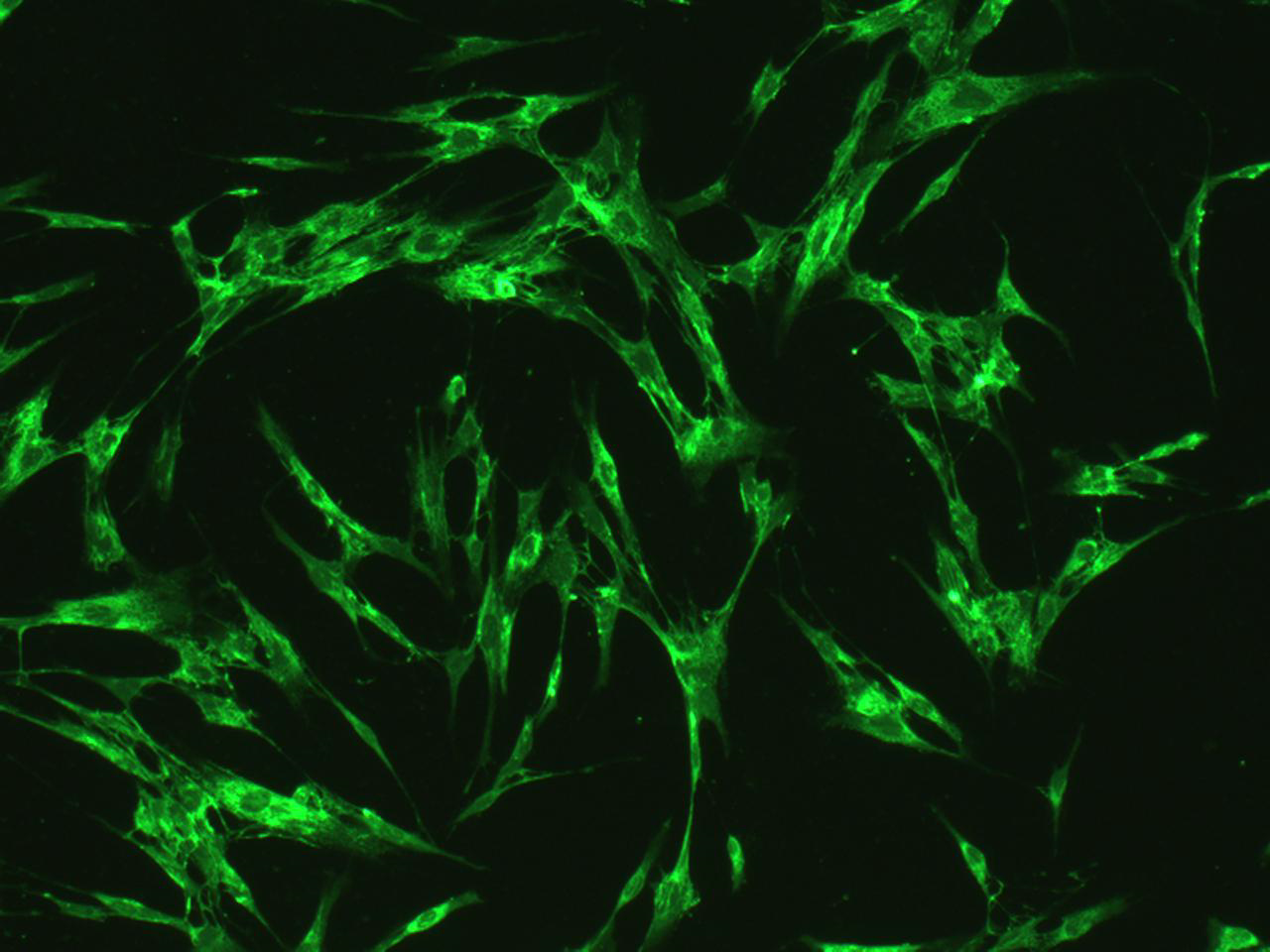 绿色荧光蛋白标记小鼠子宫颈癌细胞,U14-GFP细胞