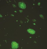 大鼠脑胶质瘤细胞 C6细胞 