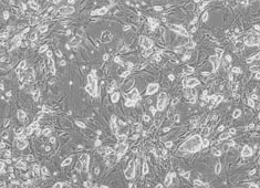 大鼠骨肉瘤细胞 UMR-106细胞 