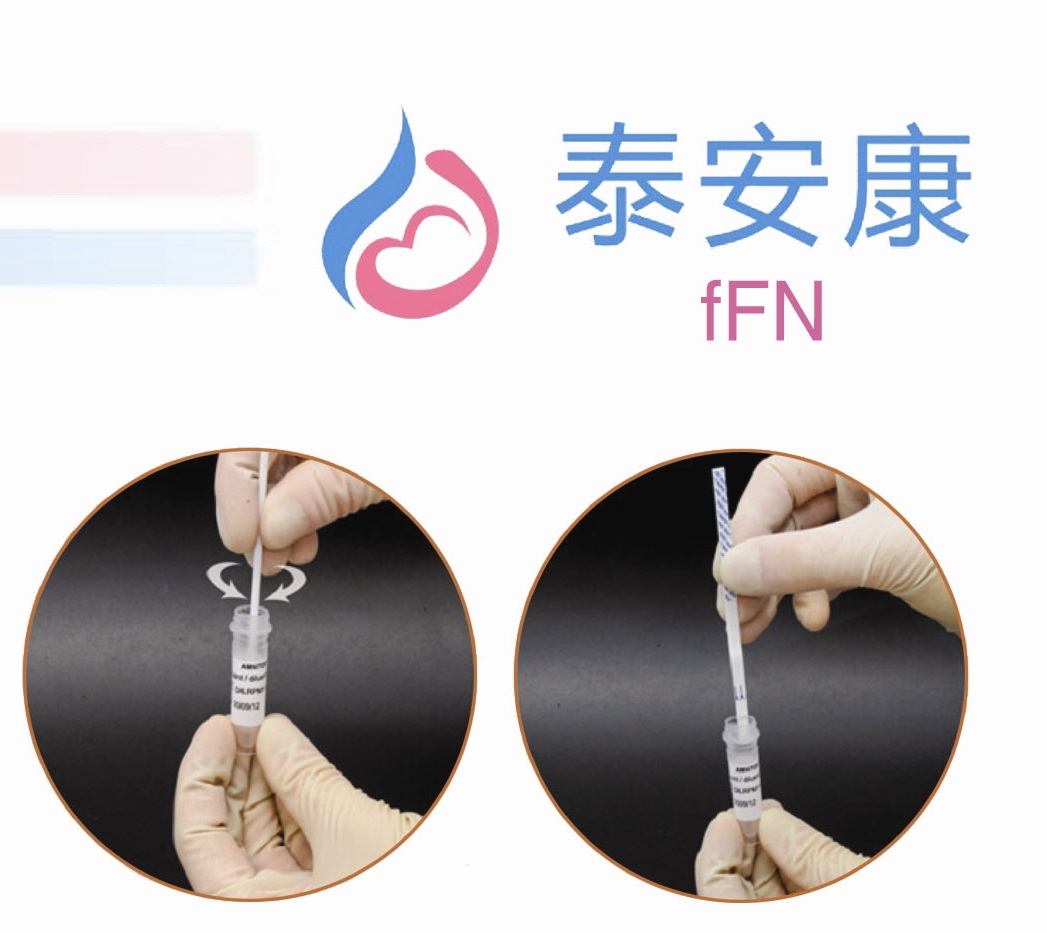 fFN胎儿纤维连接蛋白检测试剂盒