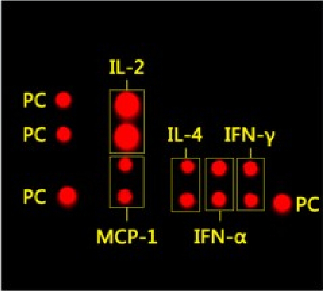 人细胞因子5项定量联合检测试剂盒（fg级）