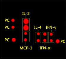 人细胞因子5项定量联合检测试剂盒（fg级）