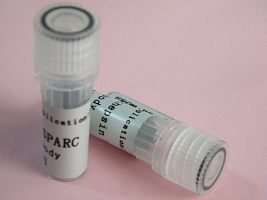 腺苷单磷酸活化蛋白激酶β1抗体