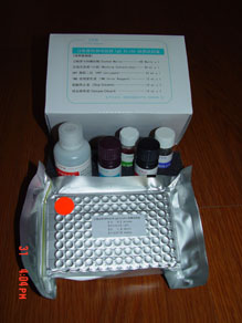 人白介素17(IL-17)检测试剂盒