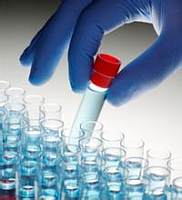 磷酸化促凋亡调节蛋白BNIP3抗体