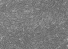 杂交瘤细胞枝原体阳性