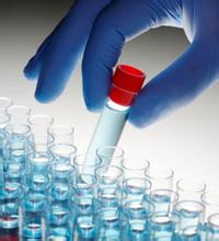 钙/钙调素依赖蛋白激酶2α抗体