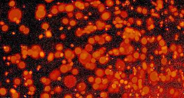 中国仓鼠肺细胞