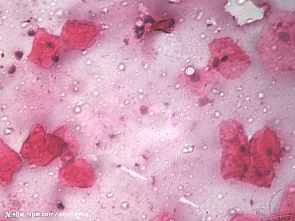 小鼠肛门肉瘤细胞