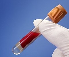 解整合素金属蛋白酶33(ADAM33)重组蛋白