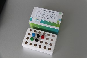 人ALDH2基因多态性检测试剂盒（荧光PCR法）