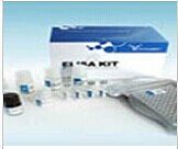 肾上腺髓质素检测试剂盒