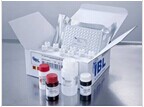 细胞毒性T淋巴细胞相关抗原4检测试剂盒