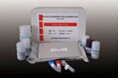 S100B蛋白检测试剂盒