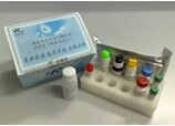 可溶性血管细胞粘附分子1检测试剂盒
